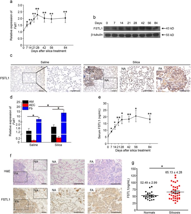 7 dust silica 1 induced mouse aggravates lung Follistatin like 7 dust silica 1 induced mouse aggravates lung Follistatin like