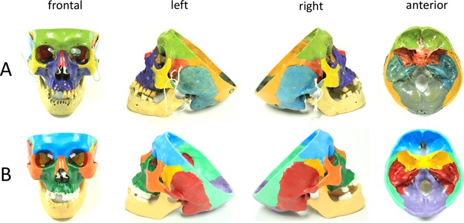 Free Anatomical Models For 3d Printing