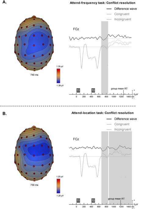 Neural Correlates Of Distraction And Conflict Resolution For Nonverbal Auditory Events 