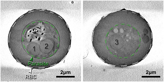 Biochemistry Of Malaria Parasite Infected Red Blood Cells By X Ray Microscopy Scientific Reports
