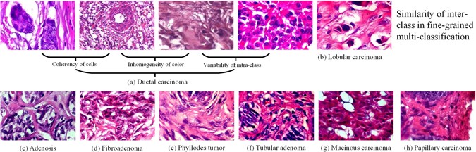 Breast Cancer Multi-classification from Histopathological Images with  Structured Deep Learning Model | Scientific Reports
