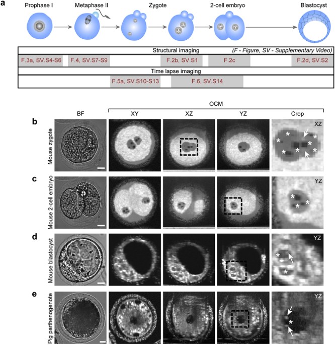 Optical coherence microscopy as a novel, noninvasive method for the 4D