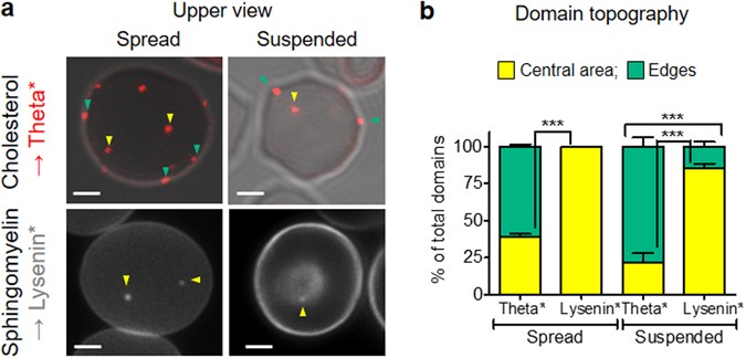 Contribution of plasma membrane lipid domains to red blood cell (re)shaping