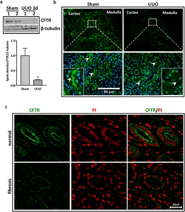 Defective Cftr Leads To Aberrant B Catenin Activation And Kidney Fibrosis Scientific Reports