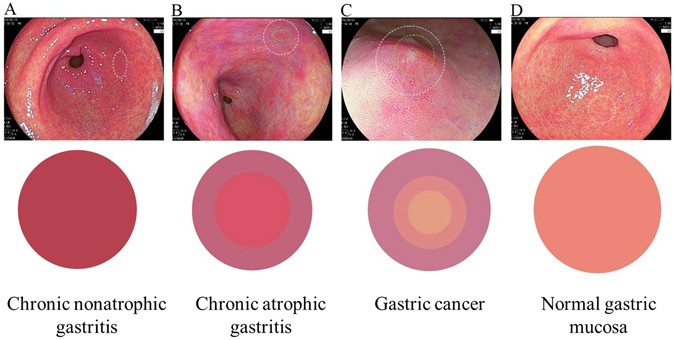 for scientific how group control study is important imaging endoscopic Linked benefits the diagnosis of colour