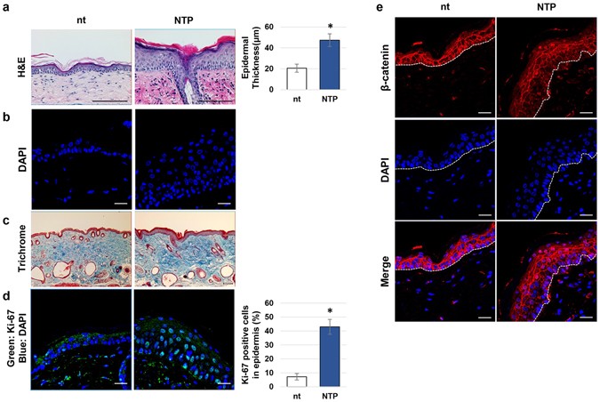 Skin renewal activity of non-thermal plasma through the activation of \u03b2 ...