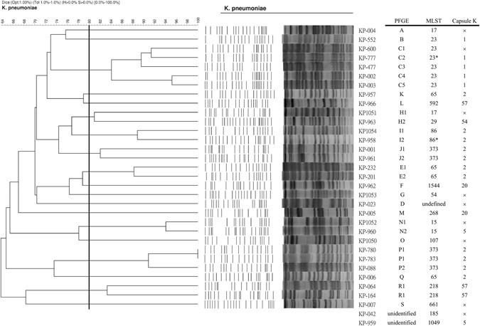 Klebsiella Pneumoniae Isolates From Meningitis Epidemiology Virulence And Antibiotic Resistance Scientific Reports