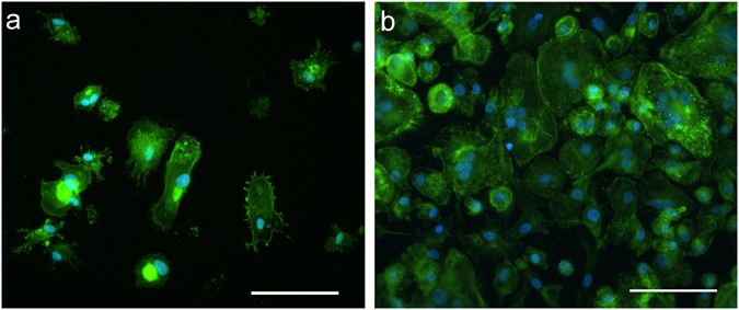 Classification of M1/M2-polarized human macrophages by label-free  hyperspectral reflectance confocal microscopy and multivariate analysis |  Scientific Reports