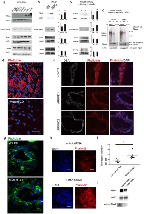 Nedd4 Family Ligase Dysfunction Due To Pkhd1 Pkhd1 Defects Suggests A Mechanistic Model For Arpkd Pathobiology Scientific Reports Nedd4 Family Ligase Dysfunction Due To Pkhd1 Pkhd1 Defects Suggests A Mechanistic Model For Arpkd Pathobiology Scientific Reports