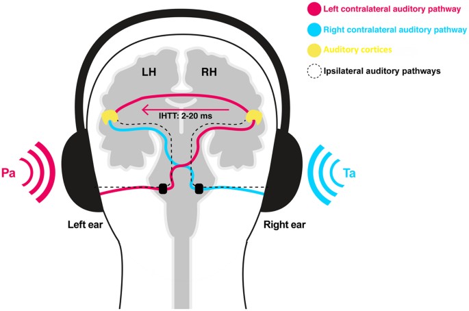 schizophrenia auditory hallucinations