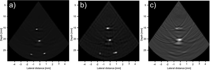 Compensated Row-Column Ultrasound Imaging System Using Multilayered ...