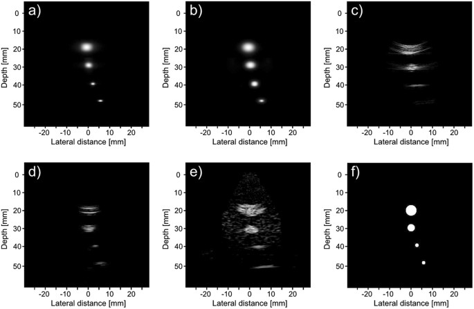 Compensated Row-Column Ultrasound Imaging System Using Multilayered ...