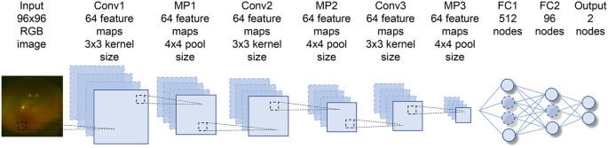 Accuracy of deep learning, a machine-learning technology, using  ultra–wide-field fundus ophthalmoscopy for detecting rhegmatogenous retinal  detachment | Scientific Reports