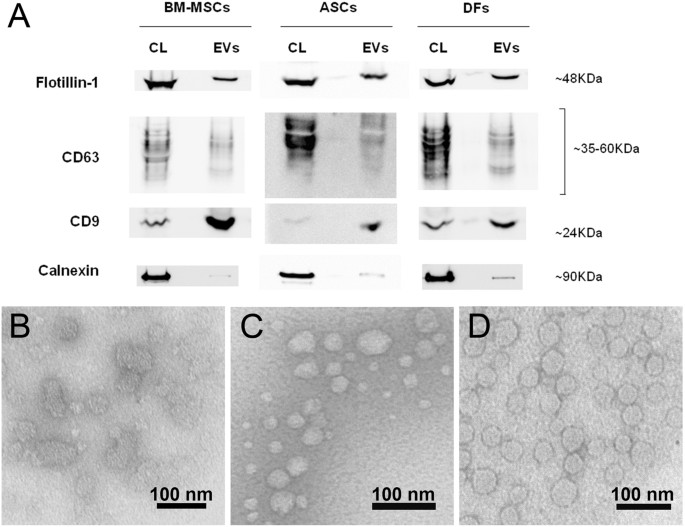 Raman spectroscopy uncovers biochemical tissue-related features of extracellular vesicles from mesenchymal stromal cells