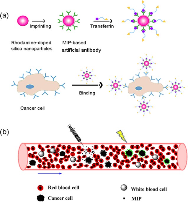 Shell shaped cancer cells