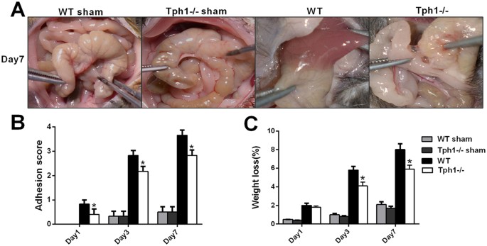 Peripheral serotonin regulates postoperative intra-abdominal adhesion formation in mice
