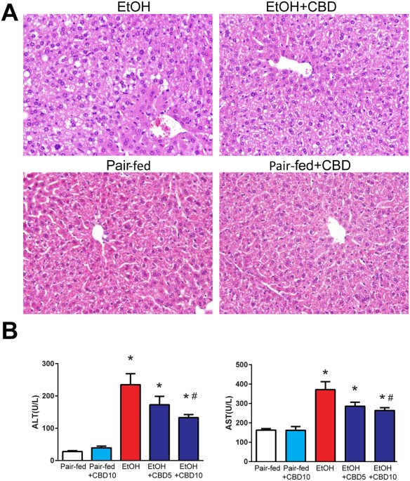 Cannabidiol attenuates alcohol-induced liver steatosis ...