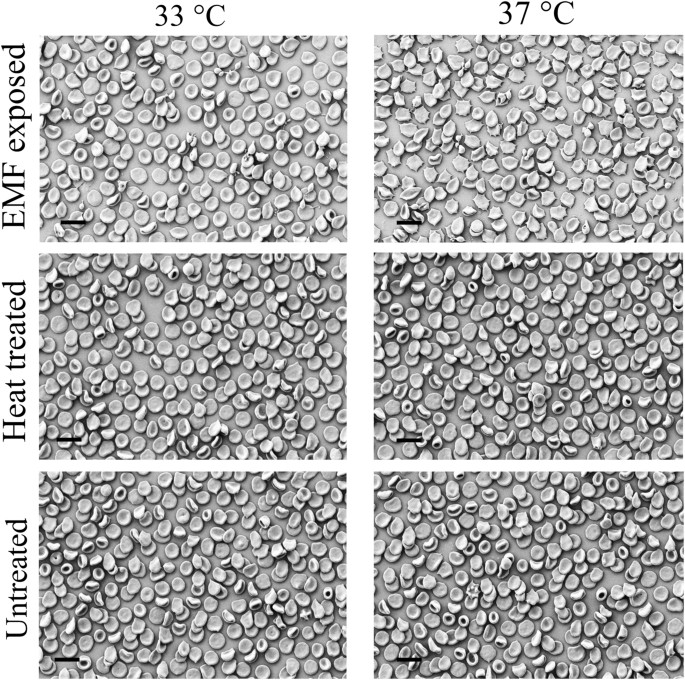 The Effect Of A High Frequency Electromagnetic Field In The Microwave Range On Red Blood Cells Scientific Reports