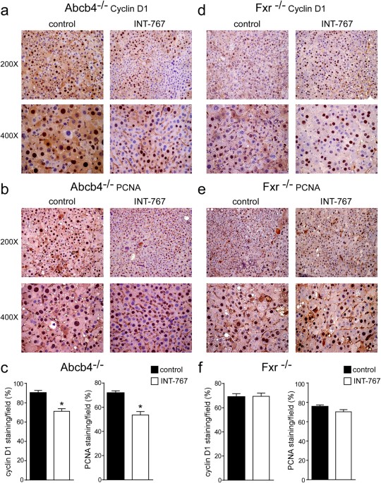 Long-term Administration of Nuclear Bile Acid Receptor FXR Agonist ...