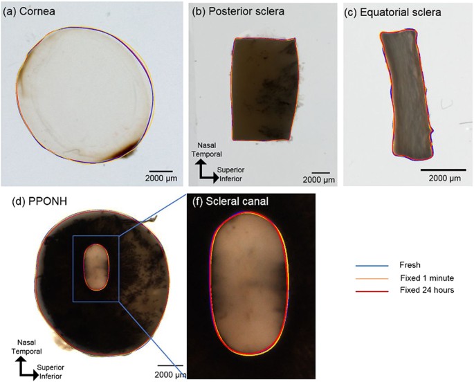 Formalin Fixation and Cryosectioning Cause Only Minimal Changes in