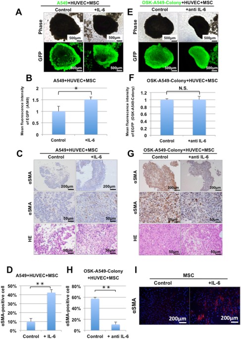 interleukin 6 blockade attenuates lung cancer tissue construction transformed cells within labeled layer c give rise to which form of cell cancer