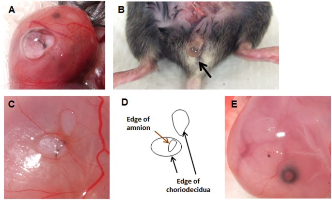 Healing Of Preterm Ruptured Fetal Membranes Scientific Reports