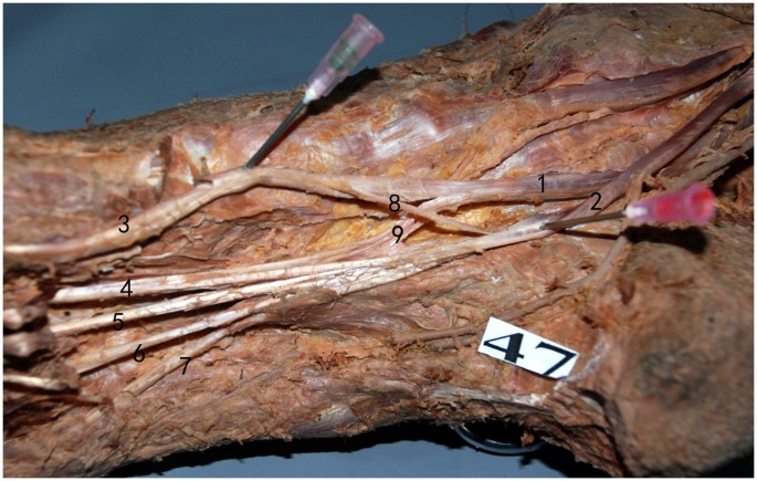 Anatomical Study Of The Neurovascular In Flexor Hallucis Longus