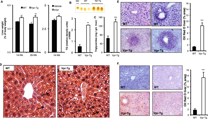 fatty liver disease, HIV-1 viral protein R (Vpr) induces fatty liver in mice via LXRα and PPARα dysregulation: implications for HIV-specific pathogenesis of NAFLD