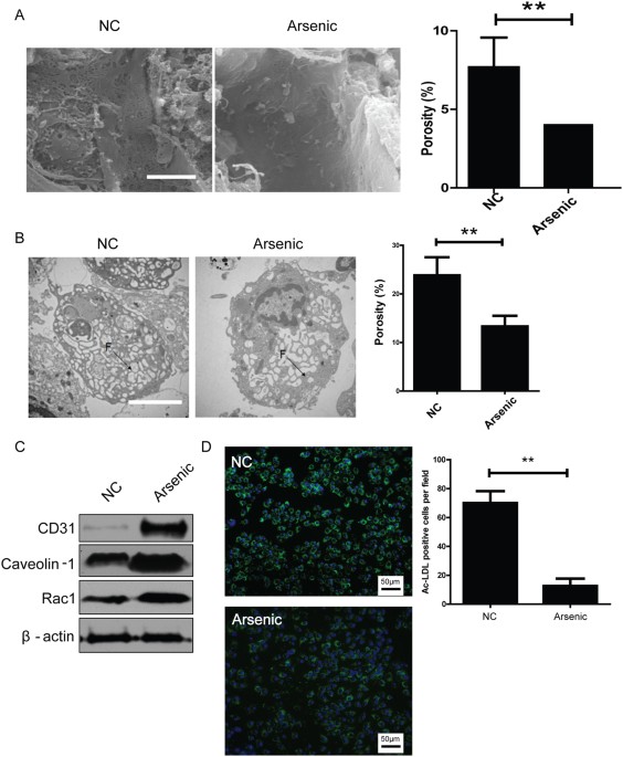 cell differentiation, Proteomic Analysis Reveals Dab2 Mediated Receptor Endocytosis Promotes Liver Sinusoidal Endothelial Cell Dedifferentiation