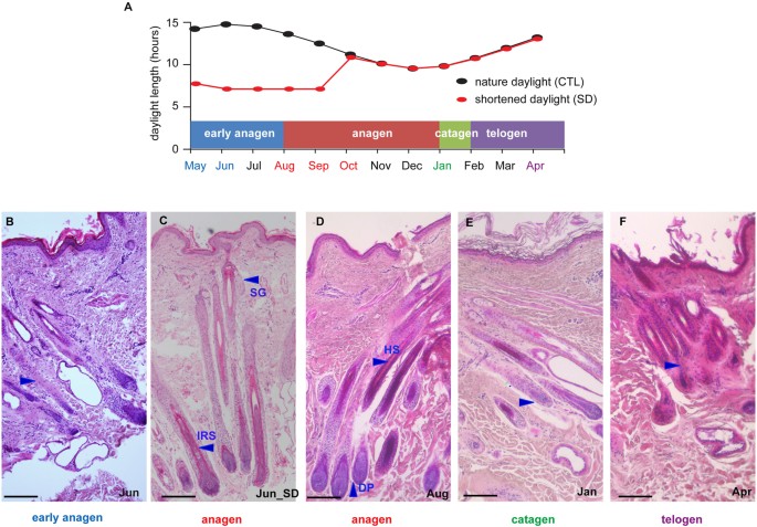 Hair Loss Breakthrough Grow Hair Via Plucking Mmrf
