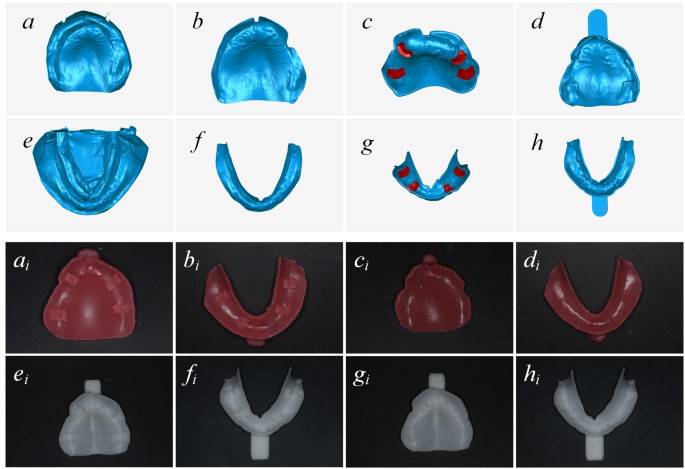 clinical evaluation of final impressions from three primary impression