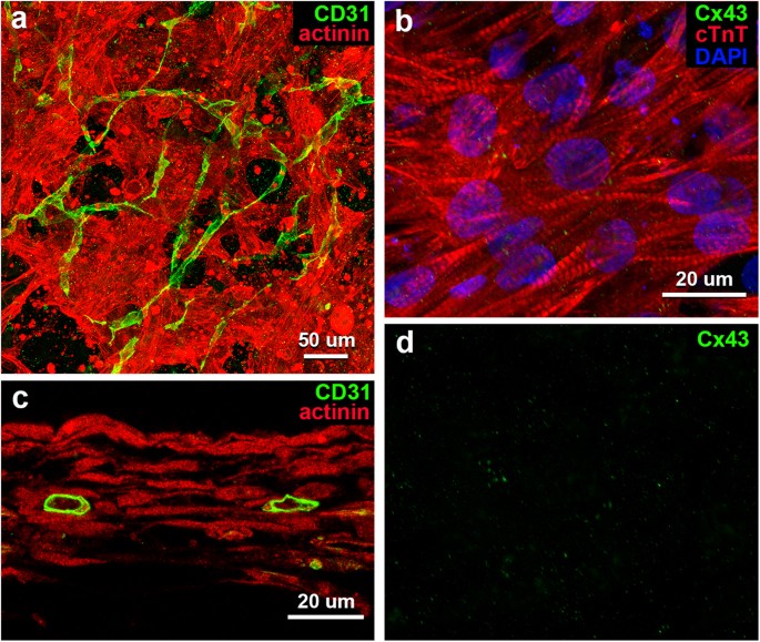 Engraftment And Morphological Development Of Vascularized Human Ips Cell Derived 3d Cardiomyocyte Tissue After Xenotransplantation Scientific Reports