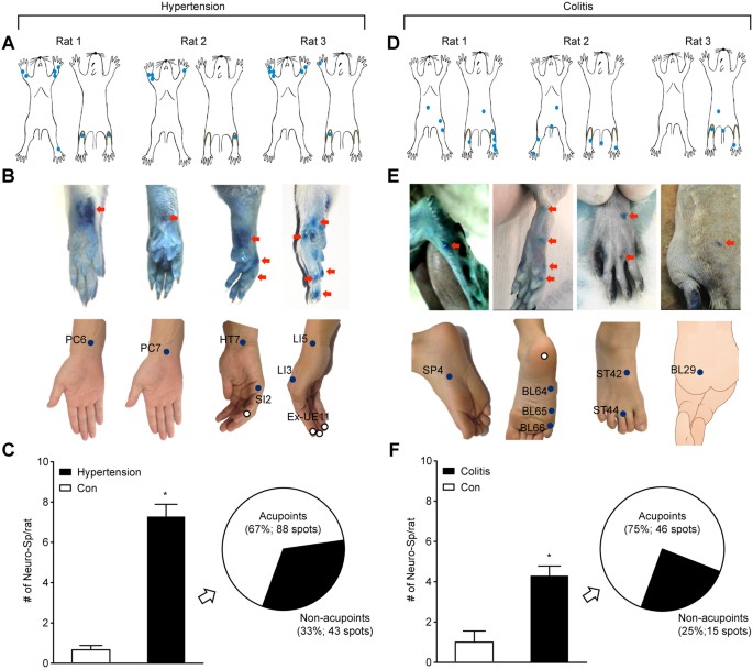 Acupuncture points can be identified as cutaneous neurogenic inflammatory  spots | Scientific Reports