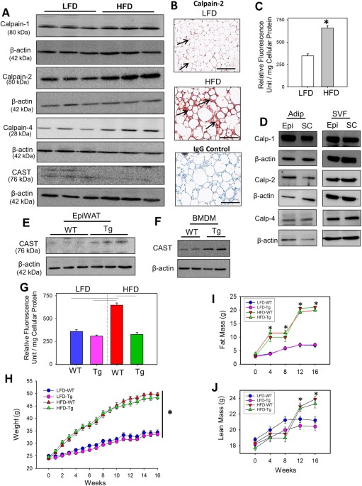 inflammation, Calpain Inhibition Attenuates Adipose Tissue Inflammation and Fibrosis in Diet-induced Obese Mice