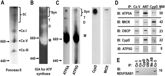 Cyclophilin D Regulates The Dynamic Assembly Of Mitochondrial Atp Synthase Into Synthasomes Scientific Reports