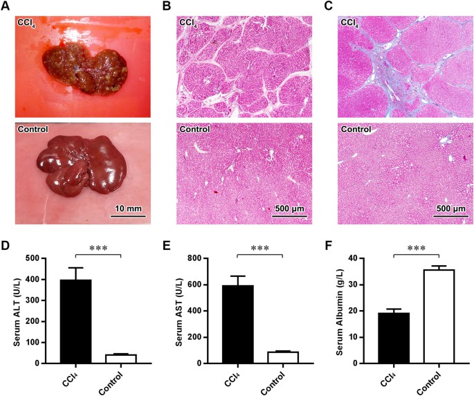 Therapeutic effects of hepatocyte growth factoroverexpressing dental