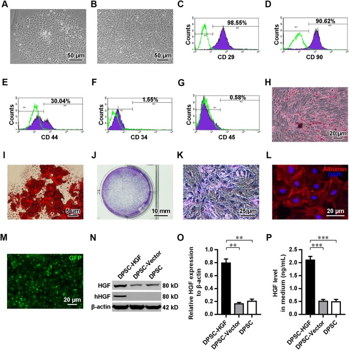 Therapeutic effects of hepatocyte growth factoroverexpressing dental