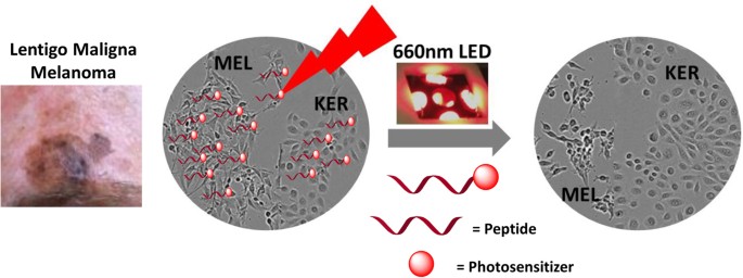 Specific Targeting of Melanotic Cells with Peptide Ligated Photosensitizers  for Photodynamic Therapy | Scientific Reports