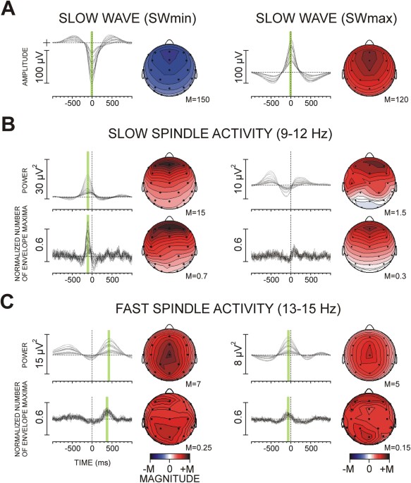 Dynamic coupling between slow waves and sleep spindles during slow wave sleep in humans is