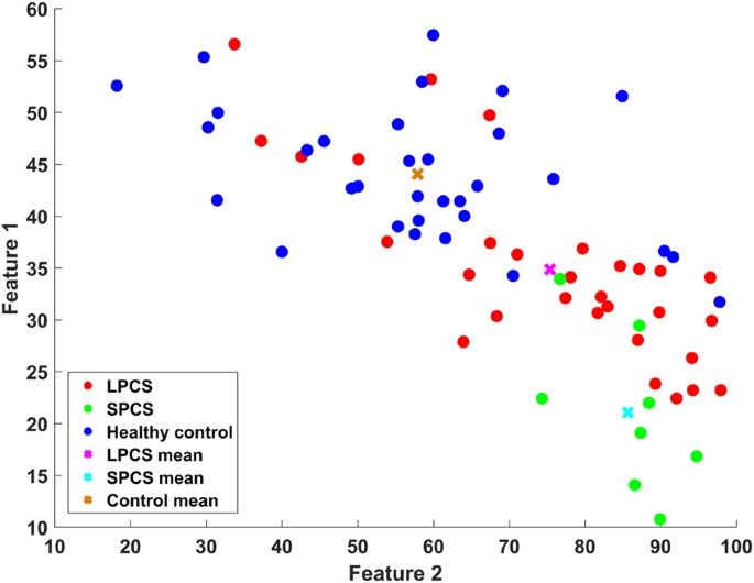 These Three Tests Detect Concussion 100 >> Quantitative Measurement Of Post Concussion Syndrome Using These Three Tests Detect Concussion 100 >> Quantitative Measurement Of Post Concussion Syndrome Using