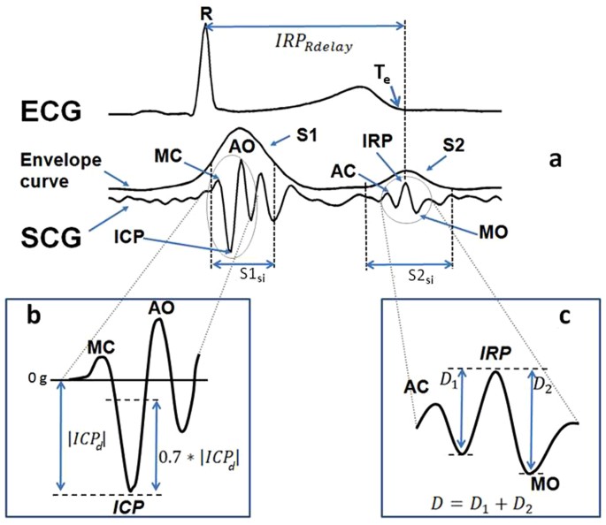 An algorithm for the beattobeat assessment of cardiac mechanics