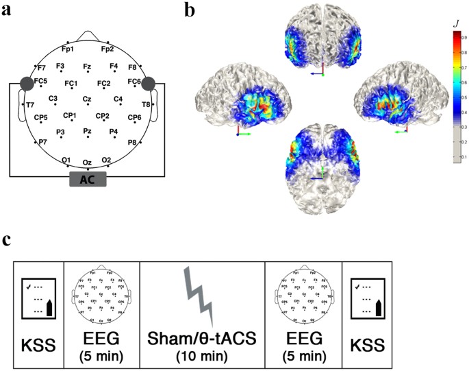 Bilateral 5 Hz transcranial alternating current stimulation on  fronto-temporal areas modulates resting-state EEG | Scientific Reports
