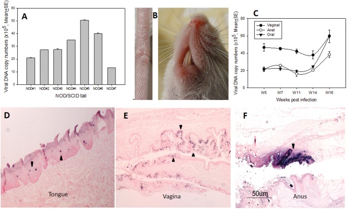mouse papillomavirus infection model