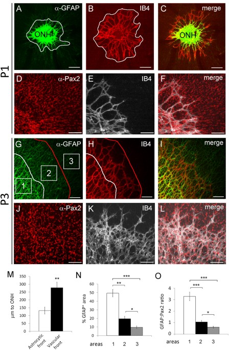 Retinal Angiogenesis Regulates Astrocytic Differentiation In Neonatal Mouse Retinas By Oxygen 2257