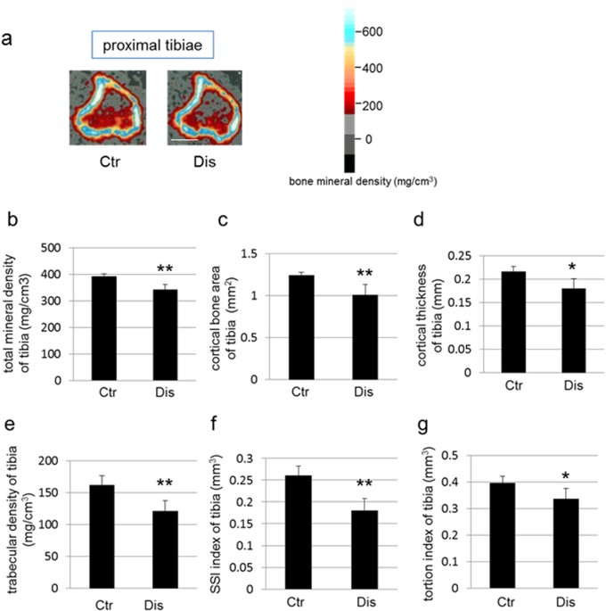 Occlusal disharmonyinduced stress causes osteopenia of the lumbar