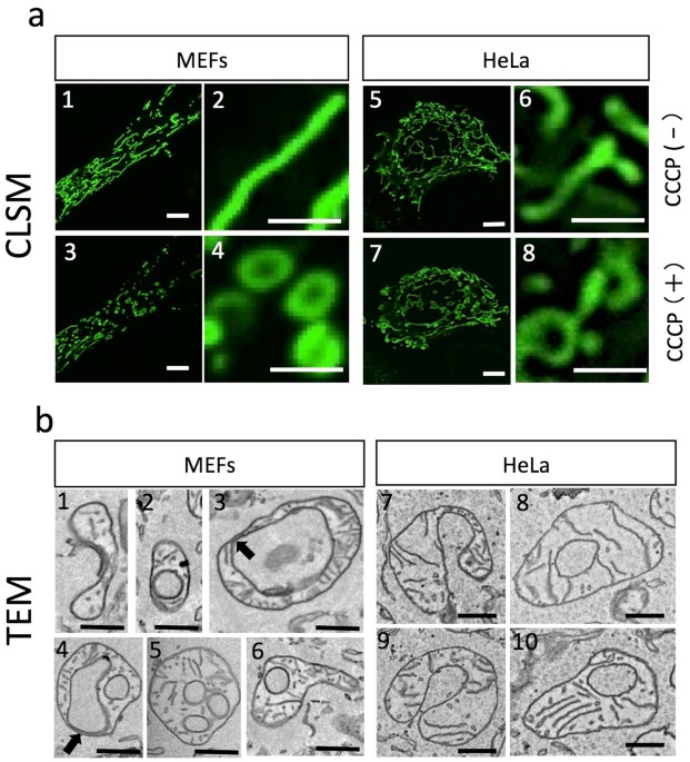 Uncoupled Mitochondria Quickly Shorten Along Their Long Axis To Form Indented Spheroids Instead Of Rings In A Fission Independent Manner Scientific Reports