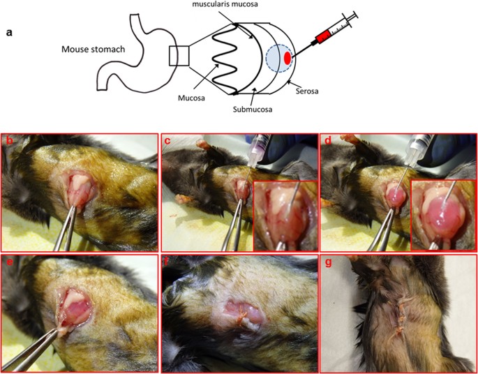 gastric cancer xenograft mouse models)