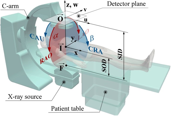 Three Dimensional Reconstruction And Nurbs Based Structured Meshing Of Coronary Arteries From The Conventional X Ray Angiography Projection Images Scientific Reports