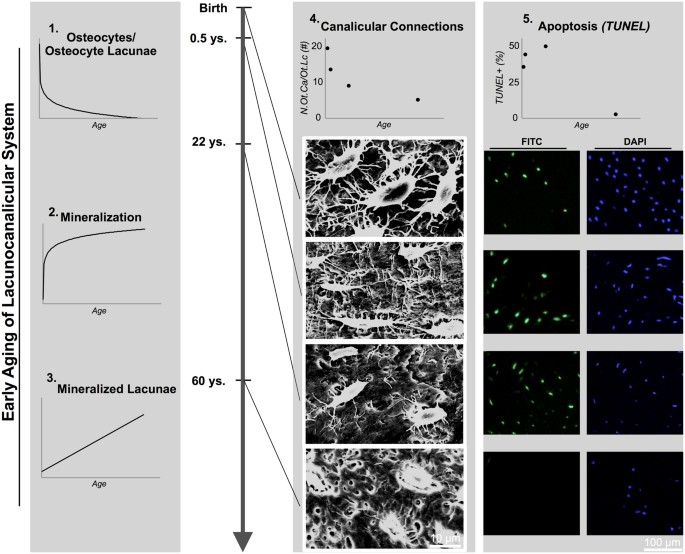 Early bone tissue aging in human auditory ossicles is accompanied by ... Early bone tissue aging in human auditory ossicles is accompanied by ...