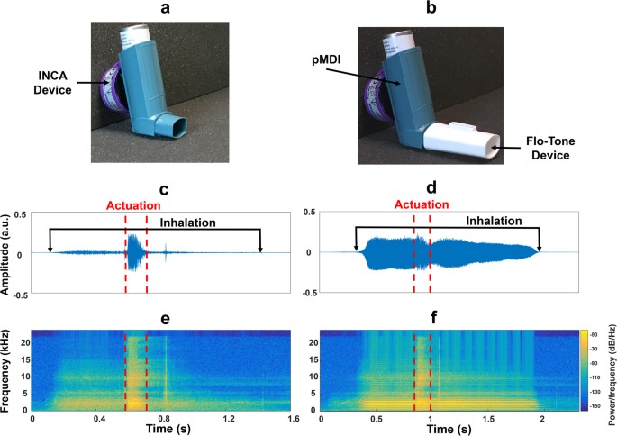 Evohaler Pmdi With The Flo Tone Attached To The Mouthpiece A Pmdi With The Inca Audio Recording Device Attached To The Back Of The Inhaler Evohaler Pmdi With The Flo Tone Attached To The Mouthpiece A Pmdi With The Inca Audio Recording Device Attached To The Back Of The Inhaler